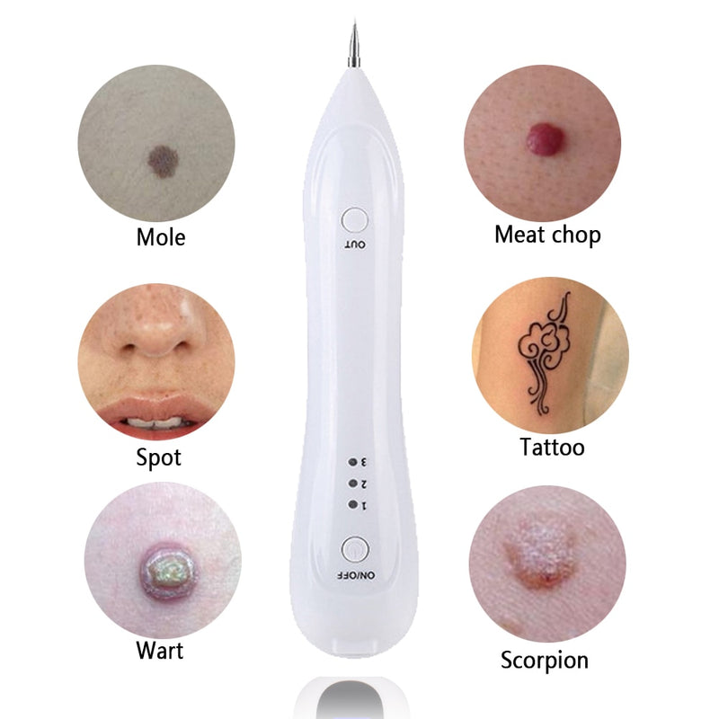 Laser Mole, Wart, Freckles & Tattoo Removal Pen - SkinGenics ™ Online Shop