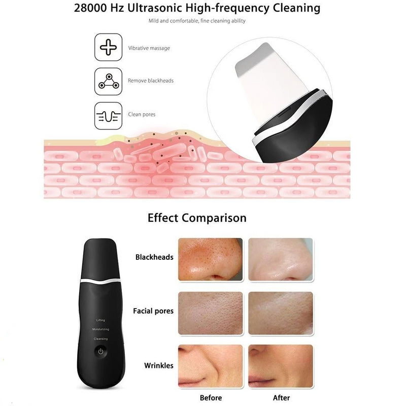 Ultrasonic Face Skin Scrubber Spatula - SkinGenics ™ Online Shop