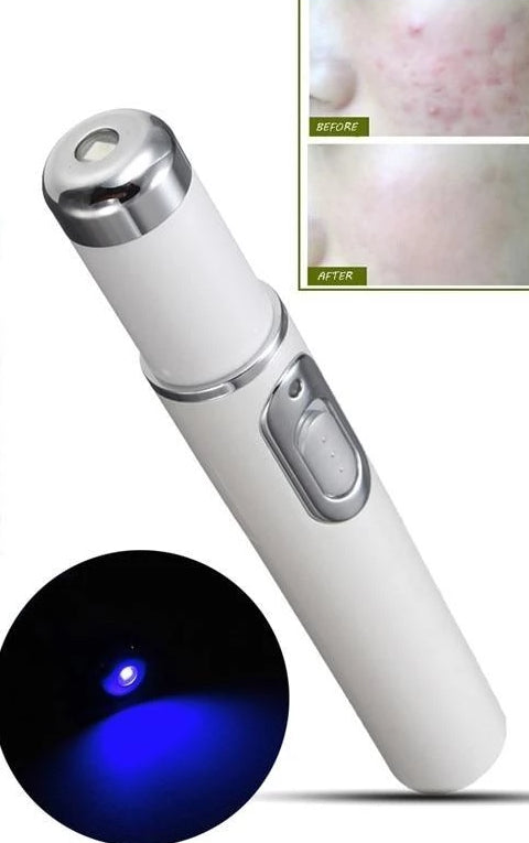 Acne Laser Pen Blue Light Therapy - SkinGenics ™ Online Shop